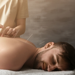 Acupuncteur, acupunctrice